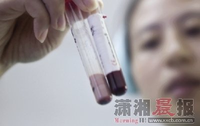 男子抽出乳白色血液 称喜欢用油汤拌饭吃(图)