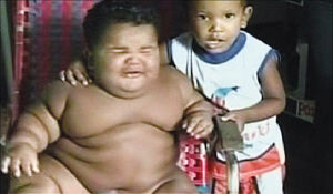 11个月大男婴体重暴增与8岁儿童体重相当
